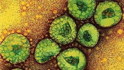 Qualquer suspeita de doença exótica ou emergente, bem como mudança no perfil epidemiológico de doenças animais, devem ser relatadas imediatamente ao Serviço Veterinário Oficia do Mapa